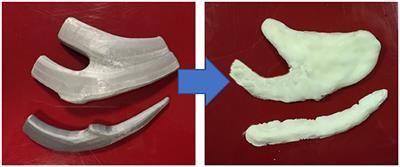 Using 3D Printing Technology to Teach Cartilage Framework Carving for Ear Reconstruction